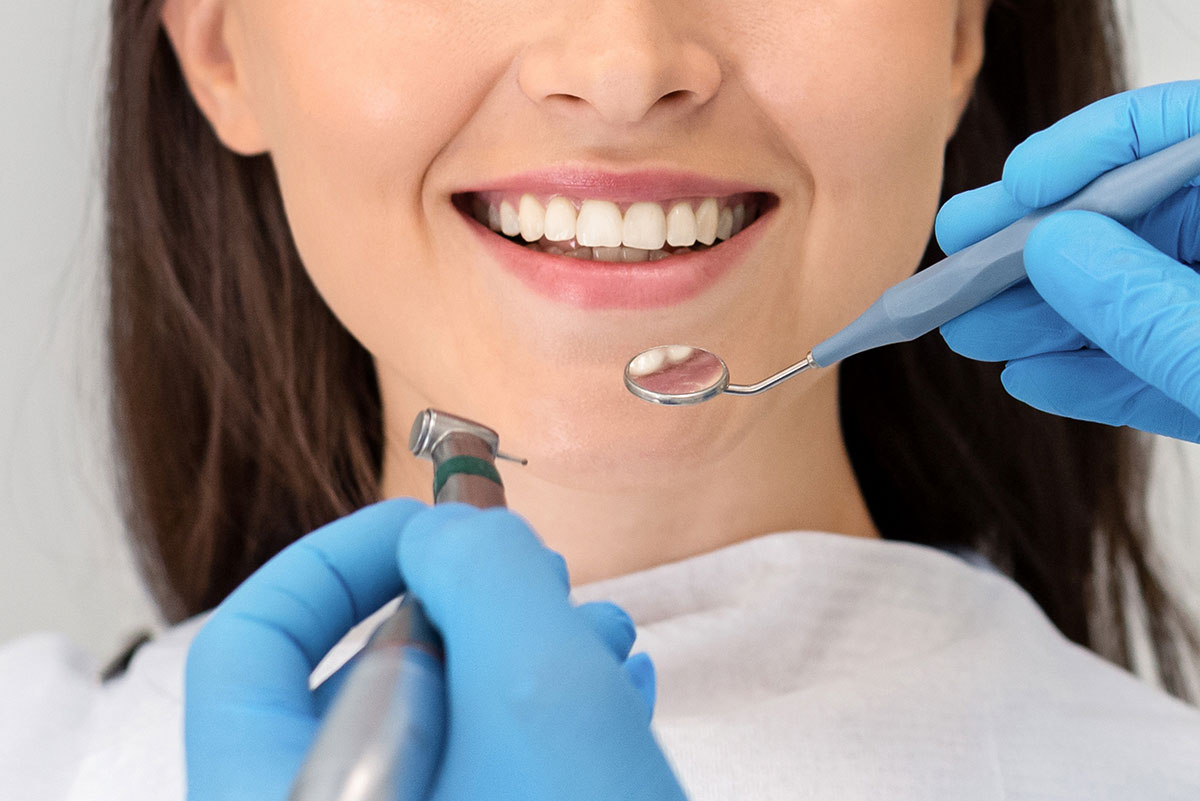 Mysmile the dental clinic in Carouge Geneva offer services such as porcelain veneers for a white smile