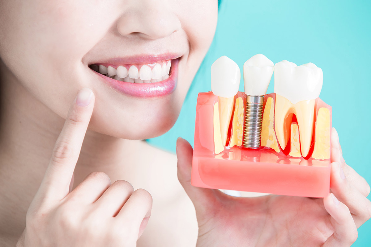 We provide the most advanced treatments for replacing a tooth with a dental implant